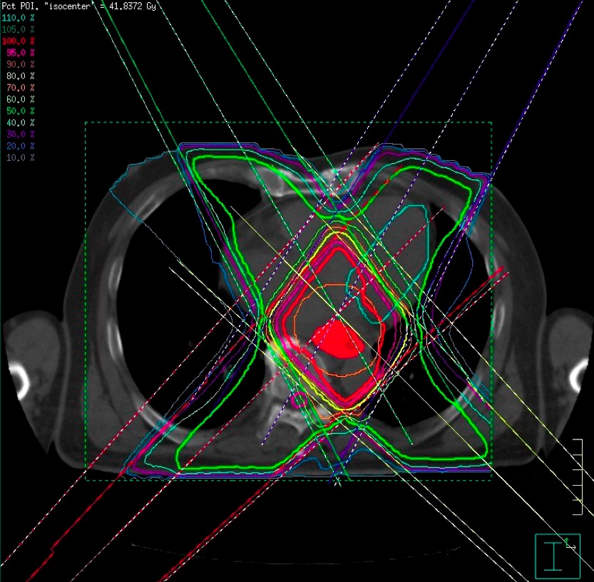 写真6:線量分布の評価 写真6:線量分布の評価