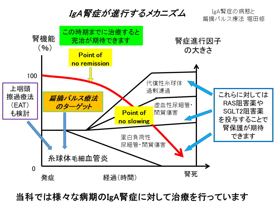 トピックス的な分野、強みとなる分野の紹介ページ（IgA腎症） (2)
